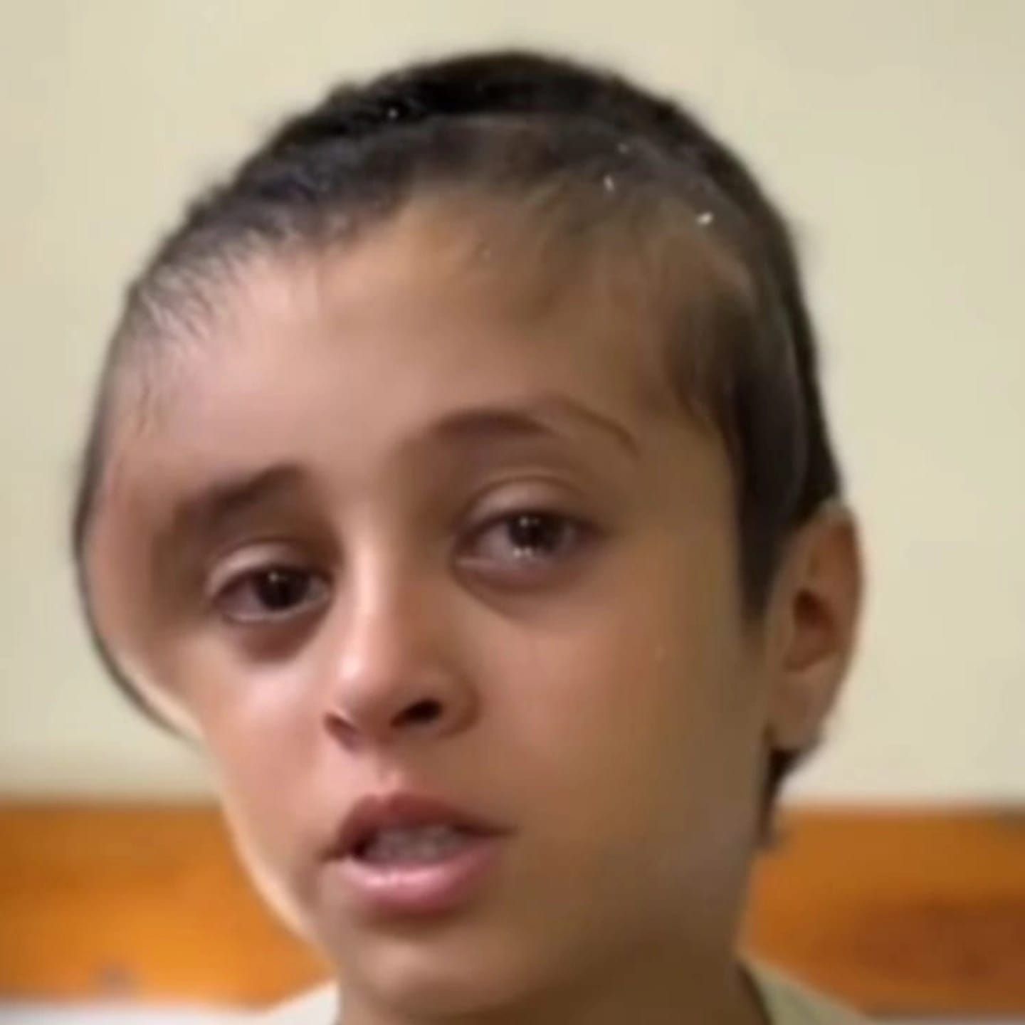 الطفلة المصابة مريم إبراهيم