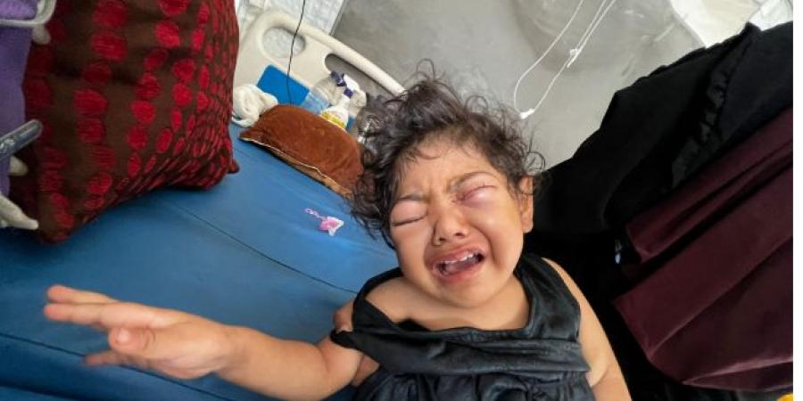 الطفلة حنين القصاص.. ضمور بالمخ يهدد حياتها مع استمرار الحرب فى غزة - زاجل الإخباري
