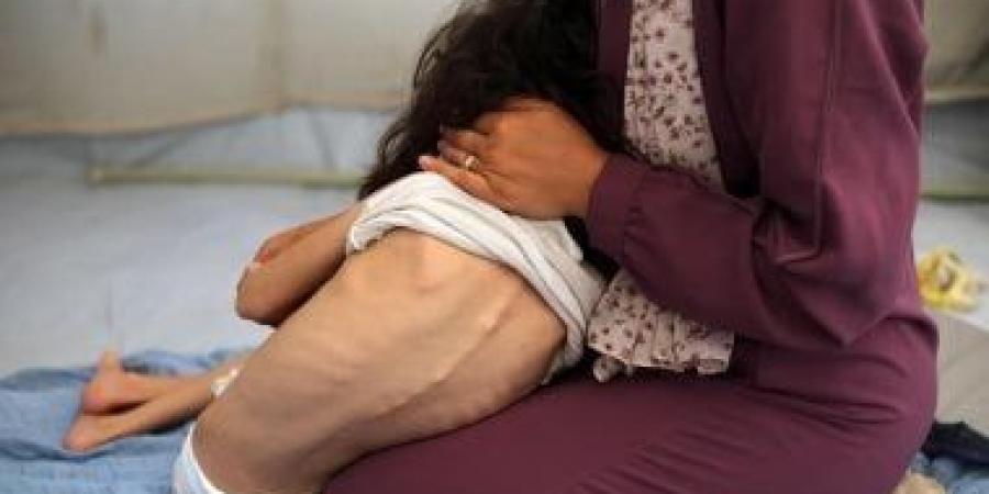 وزير الصحة الفلسطيني: المجاعة في غزة «من صنع الاحتلال» والعالم مطالب بوقف العدوان فورًا - زاجل الإخباري