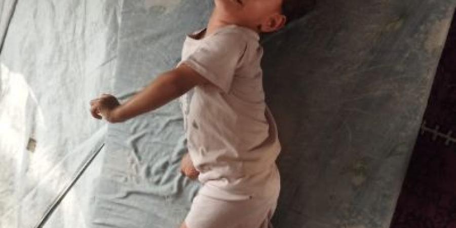 الطفلة الفلسطينية نايا أبو ريدة.. العدوان هدم طفولتها وأصابها بالشلل - زاجل الإخباري