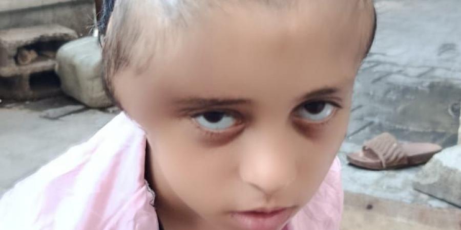 أسبوعان فقط لإنقاذها.. الاحتلال يصيب الطفلة مريم بشظية فى المخ تهدد حياتها - زاجل الإخباري